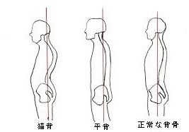 平背①